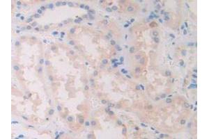 IHC-P analysis of Human Kidney Tissue, with DAB staining. (SLIT1 anticorps  (AA 647-835))
