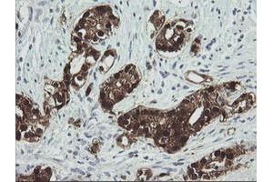Image no. 4 for anti-Cytidine Monophosphate (UMP-CMP) Kinase 1, Cytosolic (CMPK1) antibody (ABIN1497544) (Cytidine Monophosphate (UMP-CMP) Kinase 1, Cytosolic (CMPK1) anticorps)