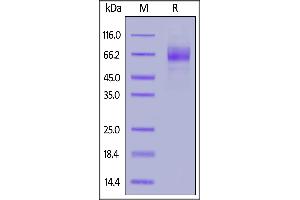 Human GUCY2C, His Tag on  under reducing (R) condition. (GUCY2C Protein (AA 24-430) (His tag))
