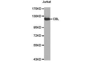 Western Blotting (WB) image for anti-Cas-Br-M (Murine) Ecotropic Retroviral Transforming Sequence (CBL) antibody (ABIN1871485) (CBL anticorps)