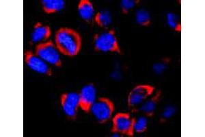 Immunofluorescence staining of vesicles (red) in RBL-2H3 (rat basophilic leukemia cell line) using Kinesin (heavy chain) monoclonal antibody, clone KN-02 . (Kinesin (heavy chain) anticorps)