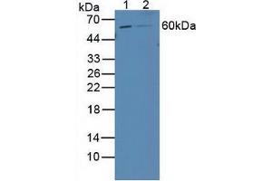 Western blot analysis of (1) Human 293T Cells and (2) Human HepG2 Cells. (Retinoic Acid Receptor beta anticorps  (AA 205-451))