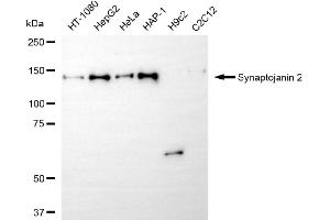 Western blotting analysis using synaptojanin 2 antibody (ABIN7800484).