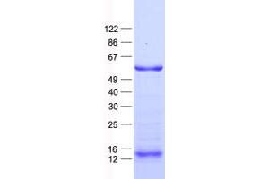 Validation with Western Blot