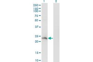 Western Blot analysis of HSFY2 expression in transfected 293T cell line by HSFY2 monoclonal antibody (M02), clone 4B7.