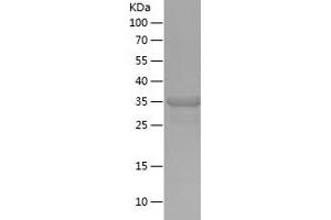 Western Blotting (WB) image for RRIO Kinase 3 (RIOK3) (AA 408-519) protein (His-IF2DI Tag) (ABIN7124935) (RIOK3 Protein (AA 408-519) (His-IF2DI Tag))