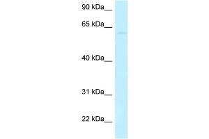 WB Suggested Anti-CCDC105 Antibody Titration: 1. (CCDC105 anticorps  (C-Term))