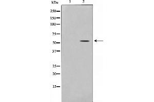 Western blot analysis on 293 cell lysate using THR1 Antibody (THRB anticorps  (Internal Region))