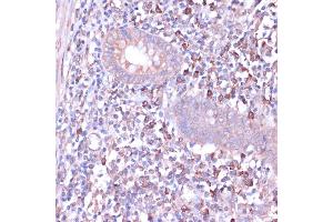 Immunohistochemistry of paraffin-embedded human appendix using PRKACB antibody (ABIN6132241, ABIN6146183, ABIN6146184 and ABIN6220953) at dilution of 1:100 (40x lens).