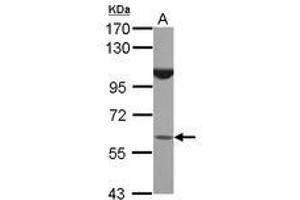 Image no. 1 for anti-BTB (POZ) Domain Containing 16 (BTBD16) (AA 1-255) antibody (ABIN1496968) (BTBD16 anticorps  (AA 1-255))