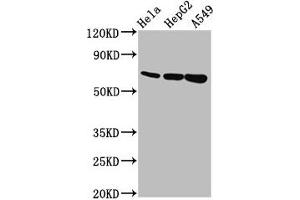 Western Blot Positive WB detected in: Hela whole cell lysate, HepG2 whole cell lysate, A549 whole cell lysate All lanes: MUC20 antibody at 5. (MUC2 anticorps  (AA 569-657))