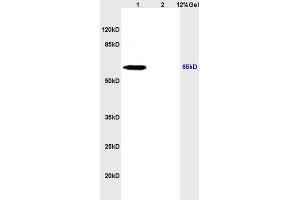 L1 rat brain lysates L2 rat kidney lysates probed with Anti NIS Polyclonal Antibody, Unconjugated (ABIN668751) at 1:200 overnight at 4 °C.
