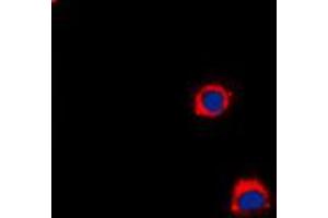 Immunofluorescent analysis of CD40 staining in A431 cells. (CD40 anticorps  (C-Term))