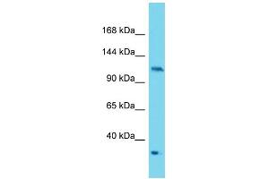 Western Blotting (WB) image for anti-Protein Kinase N2 (PKN2) (C-Term) antibody (ABIN2788942) (PKN2 anticorps  (C-Term))