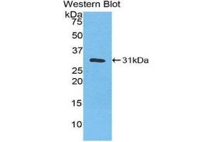 Western Blotting (WB) image for anti-Carbonic Anhydrase III (CA3) (AA 2-260) antibody (ABIN1077893) (CA3 anticorps  (AA 2-260))