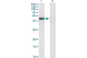 Western Blot analysis of T expression in transfected 293T cell line by T monoclonal antibody (M02), clone 5C5.