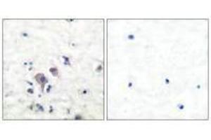 Immunohistochemical analysis of paraffin-embedded human brain tissue using GluR2/3 antibody. (Metabotropic Glutamate Receptor 3 anticorps)