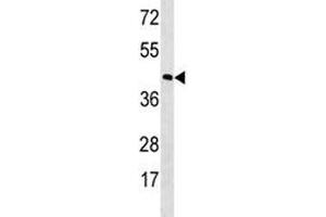 RHO antibody western blot analysis in MDA-MB453 lysate.