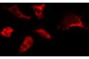 ABIN6278190 staining HepG2 by IF/ICC. (BORA anticorps  (C-Term))