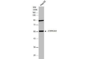 WB Image Whole cell extract (30 μg) was separated by 10% SDS-PAGE, and the membrane was blotted with CYP17A1 antibody [N1C2] , diluted at 1:1000. (CYP17A1 anticorps  (Center))