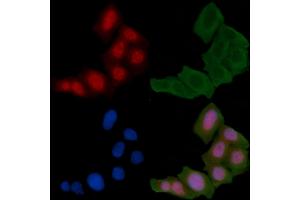 ABIN6255135 and ABIN6267411 staining Hela cells(24h of starvation treatment) by IF/ICC. (JunD anticorps  (pSer255))
