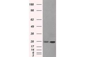 Image no. 2 for anti-Hydroxysteroid (17-Beta) Dehydrogenase 10 (HSD17B10) antibody (ABIN1498723) (HSD17B10 anticorps)