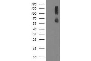 Image no. 1 for anti-Protein Phosphatase, Mg2+/Mn2+ Dependent, 1G (PPM1G) antibody (ABIN1500378) (PPM1G anticorps)