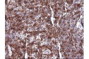 Immunohistochemistry (IHC) image for anti-T-cell surface glycoprotein CD1c (CD1C) antibody (ABIN2670659) (CD1c anticorps)