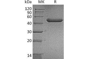 Western Blotting (WB) image for Chitinase 3-Like 3 (CHI3L3) (P105S) protein (His tag) (ABIN7320844)