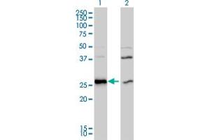 Western Blot analysis of DNAJB6 expression in transfected 293T cell line by DNAJB6 polyclonal antibody (A01).