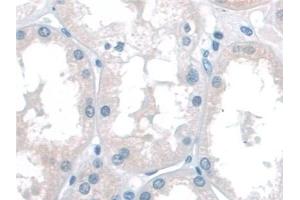Detection of KATNA1 in Human Kidney Tissue using Polyclonal Antibody to Katanin P60 Subunit A 1 (KATNA1) (KATNA1 anticorps  (AA 8-229))