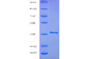 SDS-PAGE (SDS) image for Small Ubiquitin Related Modifier Protein 1 (SUMO1) (AA 2-98) protein (His-SUMO Tag) (ABIN5711265)