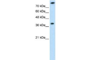 WB Suggested Anti-TST Antibody  Titration: 1 ug/ml Positive Control: Jurkat cell lysate (TST anticorps  (Middle Region))