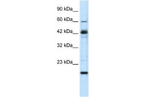 WB Suggested Anti-ZNF24 Antibody Titration:  0. (ZNF24 anticorps  (Middle Region))