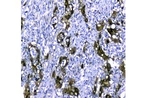 IHC analysis of STUB1 using anti-STUB1 antibody . (STUB1 anticorps  (AA 51-303))