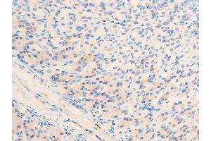 ABIN6267272 at 1/100 staining mouse gastric tissue sections by IHC-P.