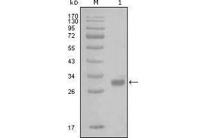 Western blot analysis using PAR1 mouse mAb against truncated GST-PAR1 recombinant protein (1). (PAR1 anticorps)