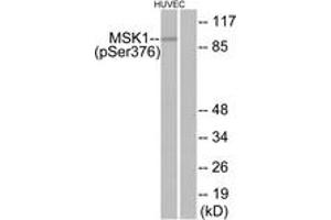 Western blot analysis of extracts from HuvEc cells treated with PMA 125ng/ml 30', using MSK1 (Phospho-Ser376) Antibody.