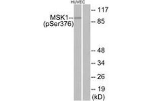 Western blot analysis of extracts from HuvEc cells treated with PMA 125ng/ml 30', using MSK1 (Phospho-Ser376) Antibody. (MSK1 anticorps  (pSer376))