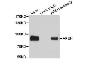 Immunoprecipitation analysis of 100ug extracts of SW480 cells using 3ug APEH antibody. (APEH anticorps  (AA 1-260))