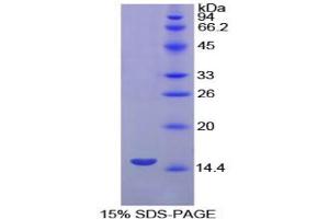 SDS-PAGE analysis of Dog Uromodulin Protein. (Uromodulin Protein (UMOD))
