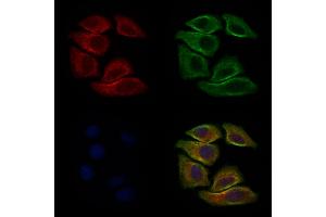 ABIN6264322 and ABIN6277635 staining Hela cells by IF/ICC. (PNMT anticorps  (N-Term))