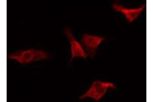 ABIN6267229 staining 293 by IF/ICC.