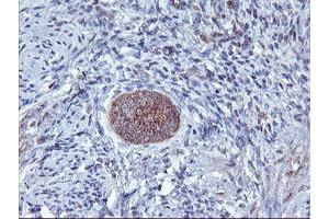 Image no. 2 for anti-1-Acylglycerol-3-Phosphate O-Acyltransferase 5 (Lysophosphatidic Acid Acyltransferase, Epsilon) (AGPAT5) antibody (ABIN1496497)