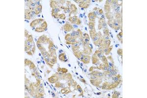 Immunohistochemistry of paraffin-embedded human gastric using EIF2S3 antibody at dilution of 1:100 (x40 lens). (EIF2S3 anticorps)