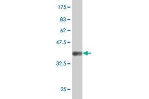Western Blot detection against Immunogen (37.
