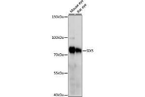 Western blot analysis of extracts of various cell lines, using SIX5 antibody (ABIN7267777) at 1000 dilution. (Six5 anticorps  (AA 1-170))
