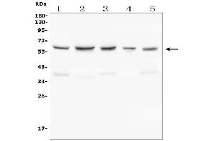 Western blot analysis of C9ORF72 using anti-C9ORF72 antibody (ABIN7603124). (C9ORF72 anticorps  (N-Term))