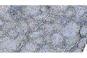 IHC analysis of CDC45L using anti-CDC45L antibody (ABIN7600230). (CDC45 anticorps  (AA 166-431))