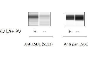 Jurkat cells were treated with Calyculin A and Pervanadate. (LSD1 Kit ELISA)